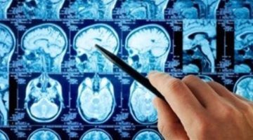 حبر سائل يمكّن الأطباء من قياس نشاط الدماغ بدقة