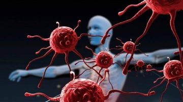 تعرف على أحدث التطورات في علاج السرطان