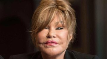 وفاة جوسلين ويلدنستين “المرأة القطة” عن 79 عاماً