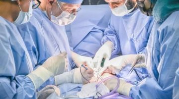 نجاح فصل التوأم الملتصق البوركيني “حوى وخديجة”
